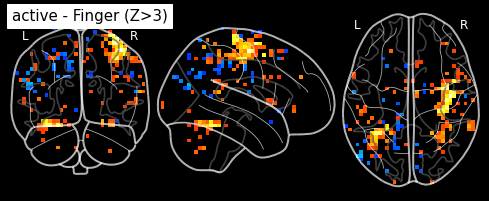 ../_images/statistical_analyses_MRI_42_0.png