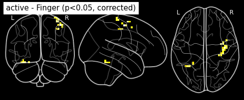 ../_images/statistical_analyses_MRI_48_0.png