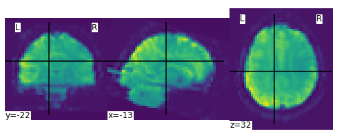 ../_images/statistical_analyses_MRI_7_1.png