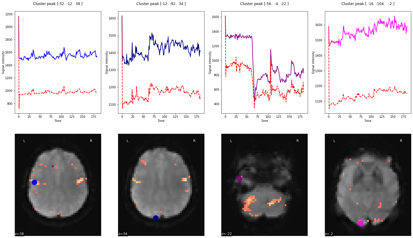 ../_images/statistical_analyses_MRI_94_0.png